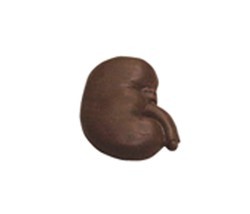 Chocolate Kidney